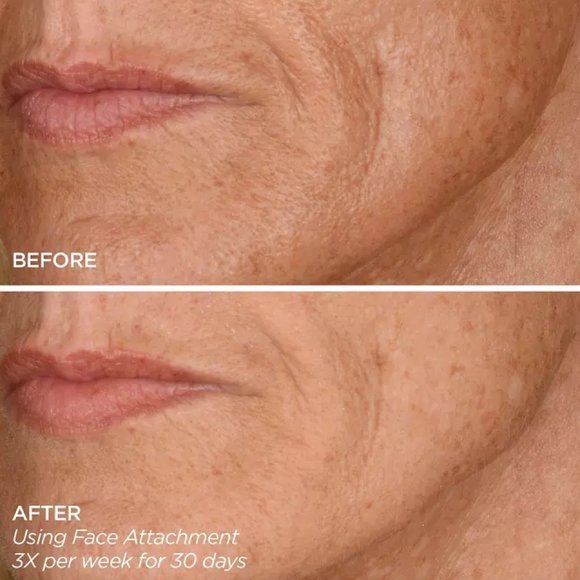 BeautyBio GloPro Microneedling Tool Set - Picture 3 of 3